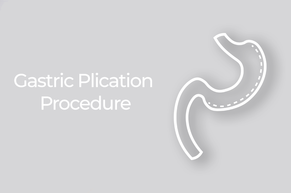 Gastric Plication Procedure
